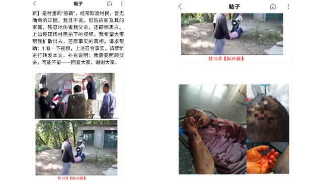 Ruan Yingxin hirió a Lei Debin con un cuchillo