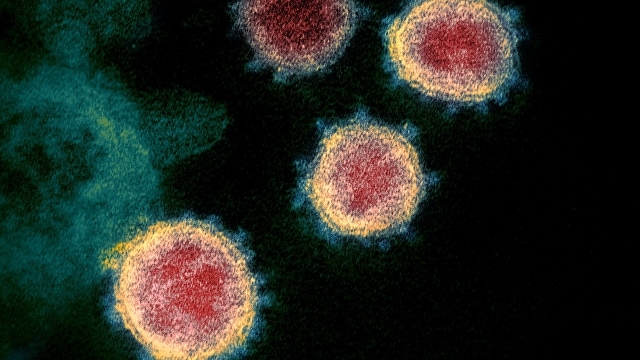 El virus responsable de la COVID-19 tal y como realmente se ve.
